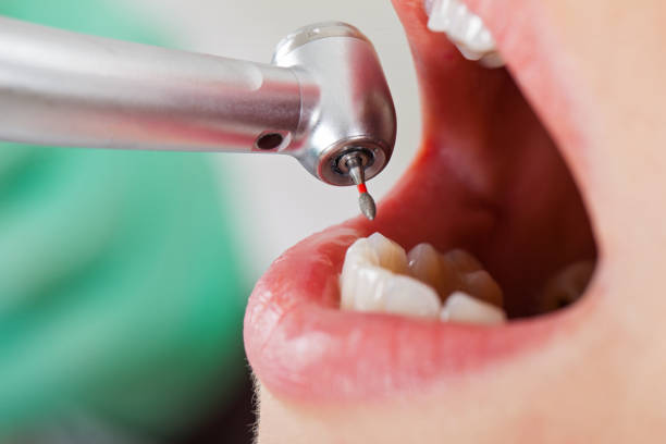 Best Emergency Treatment for Toothache in Greenhills, OH